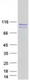 SDS-PAGE (OPA1-3996H).jpg